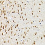 Immunohistochemistry - Anti-PSMA3 Antibody (A13403) - Antibodies.com