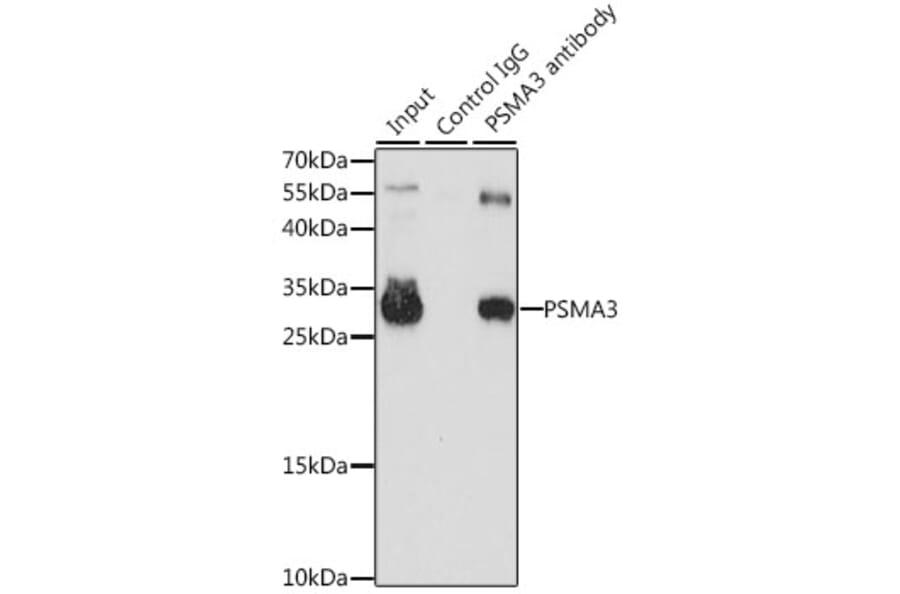 Western Blot - Anti-PSMA3 Antibody (A13403) - Antibodies.com