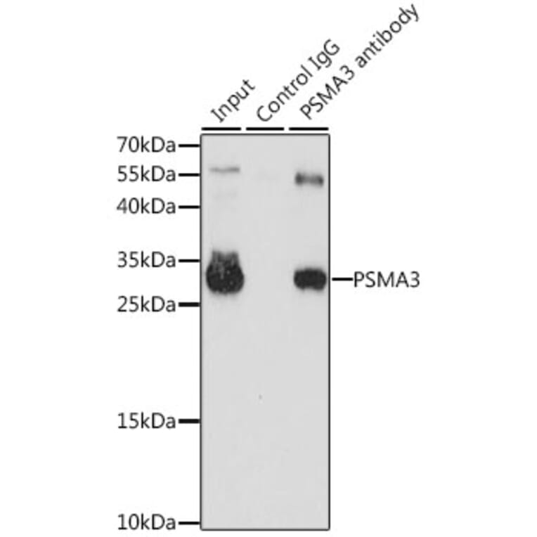 Western Blot - Anti-PSMA3 Antibody (A13403) - Antibodies.com