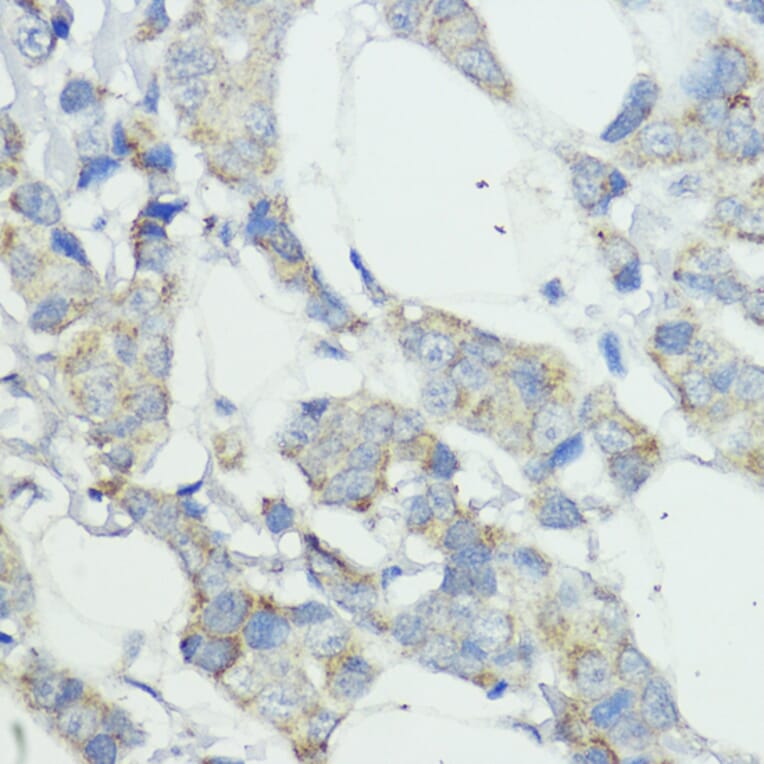 Immunohistochemistry - Anti-NOD1 Antibody (A13404) - Antibodies.com