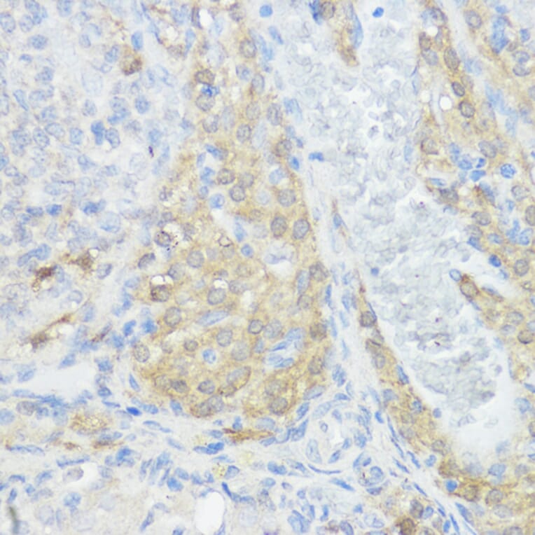 Immunohistochemistry - Anti-NOD1 Antibody (A13404) - Antibodies.com