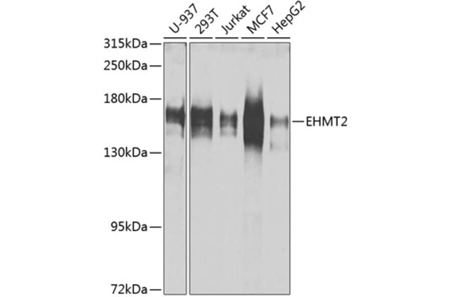 Western Blot - Anti-EHMT2/G9A Antibody (A13405) - Antibodies.com