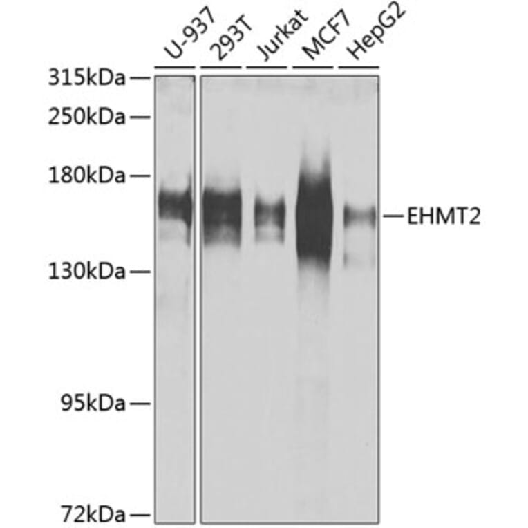 Western Blot - Anti-EHMT2/G9A Antibody (A13405) - Antibodies.com