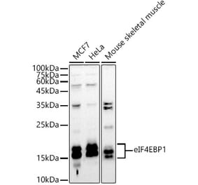 Western Blot - Anti-eIF4EBP1 Antibody (A13406) - Antibodies.com