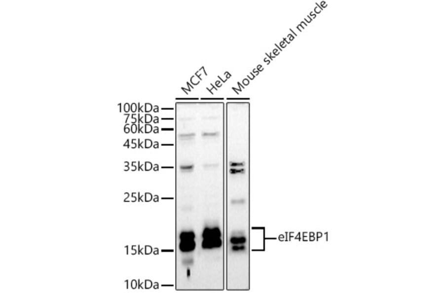 Western Blot - Anti-eIF4EBP1 Antibody (A13406) - Antibodies.com