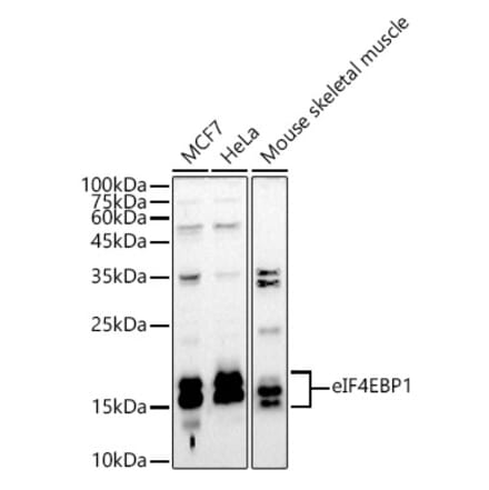 Western Blot - Anti-eIF4EBP1 Antibody (A13406) - Antibodies.com