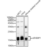 Western Blot - Anti-eIF4EBP1 Antibody (A13406) - Antibodies.com