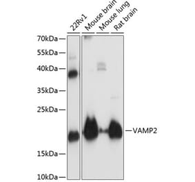 Western Blot - Anti-VAMP2 Antibody (A13407) - Antibodies.com