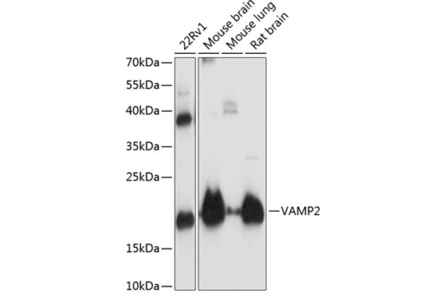Western Blot - Anti-VAMP2 Antibody (A13407) - Antibodies.com