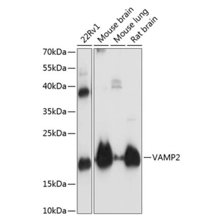 Western Blot - Anti-VAMP2 Antibody (A13407) - Antibodies.com