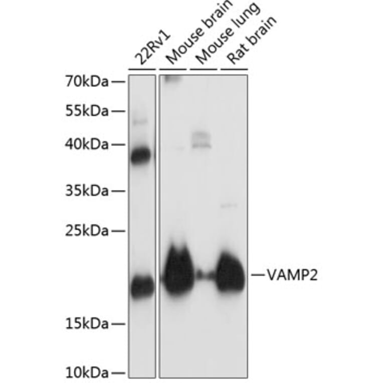 Western Blot - Anti-VAMP2 Antibody (A13407) - Antibodies.com