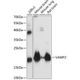 Western Blot - Anti-VAMP2 Antibody (A13407) - Antibodies.com