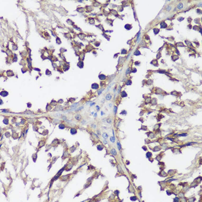 Immunohistochemistry - Anti-VAMP2 Antibody (A13407) - Antibodies.com