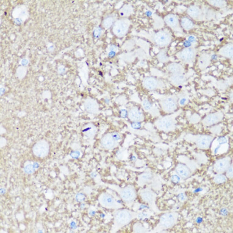 Immunohistochemistry - Anti-VAMP2 Antibody (A13407) - Antibodies.com