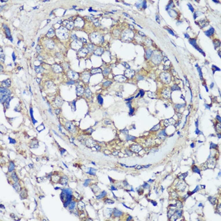 Immunohistochemistry - Anti-VAMP2 Antibody (A13407) - Antibodies.com