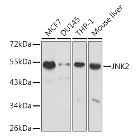 Western Blot - Anti-JNK2 Antibody (A13408) - Antibodies.com