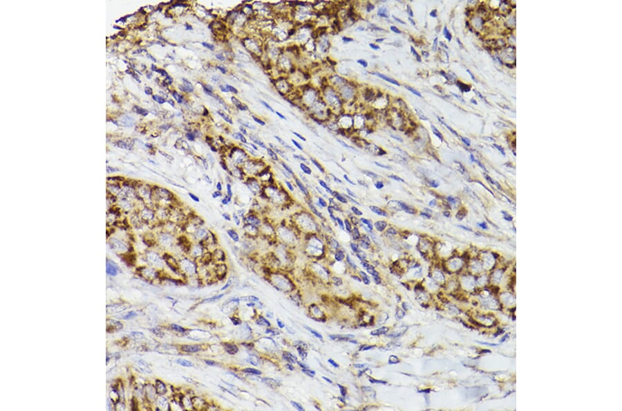 Immunohistochemistry - Anti-COX2 Antibody (A13409) - Antibodies.com