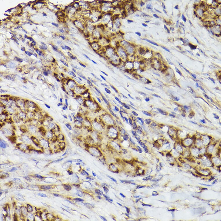 Immunohistochemistry - Anti-COX2 Antibody (A13409) - Antibodies.com