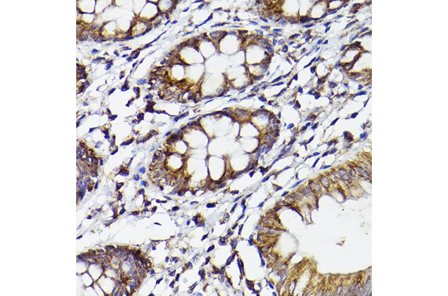Immunohistochemistry - Anti-COX2 Antibody (A13409) - Antibodies.com