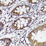 Immunohistochemistry - Anti-COX2 Antibody (A13409) - Antibodies.com