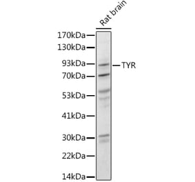 Western Blot - Anti-Tyrosinase Antibody (A13410) - Antibodies.com