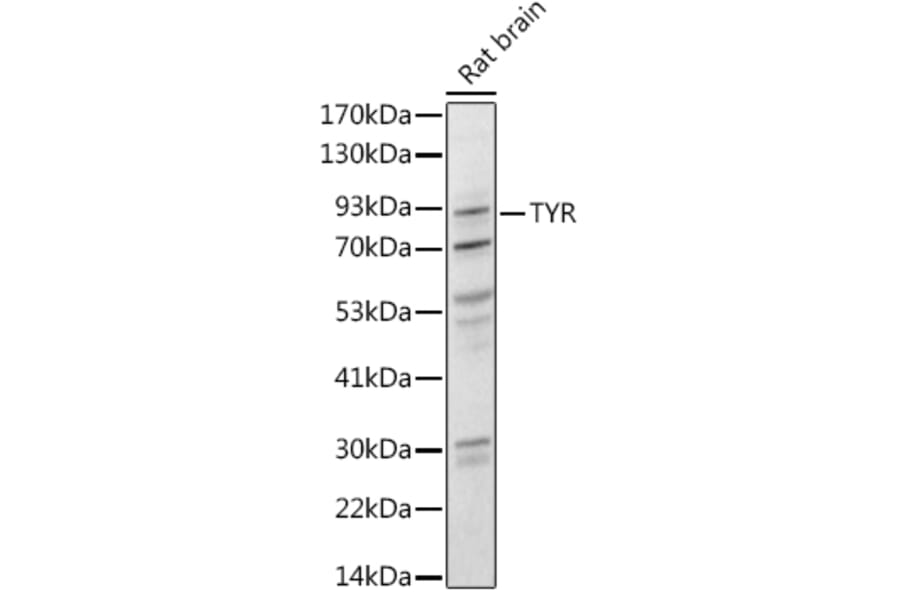 Western Blot - Anti-Tyrosinase Antibody (A13410) - Antibodies.com