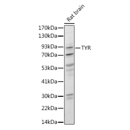 Western Blot - Anti-Tyrosinase Antibody (A13410) - Antibodies.com