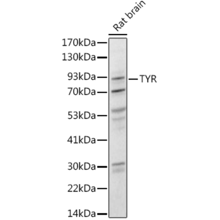 Western Blot - Anti-Tyrosinase Antibody (A13410) - Antibodies.com