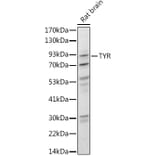 Western Blot - Anti-Tyrosinase Antibody (A13410) - Antibodies.com