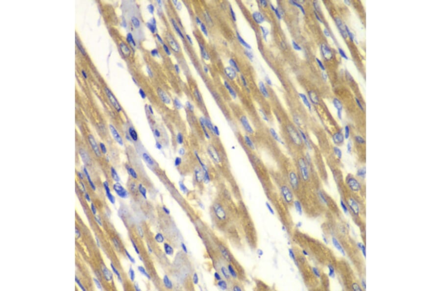 Immunohistochemistry - Anti-Tyrosinase Antibody (A13410) - Antibodies.com
