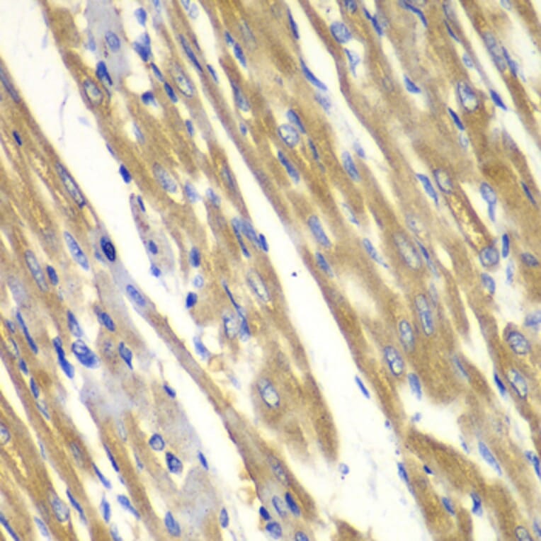 Immunohistochemistry - Anti-Tyrosinase Antibody (A13410) - Antibodies.com