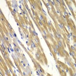 Immunohistochemistry - Anti-Tyrosinase Antibody (A13410) - Antibodies.com