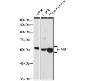 Western Blot - Anti-MiTF Antibody (A13411) - Antibodies.com