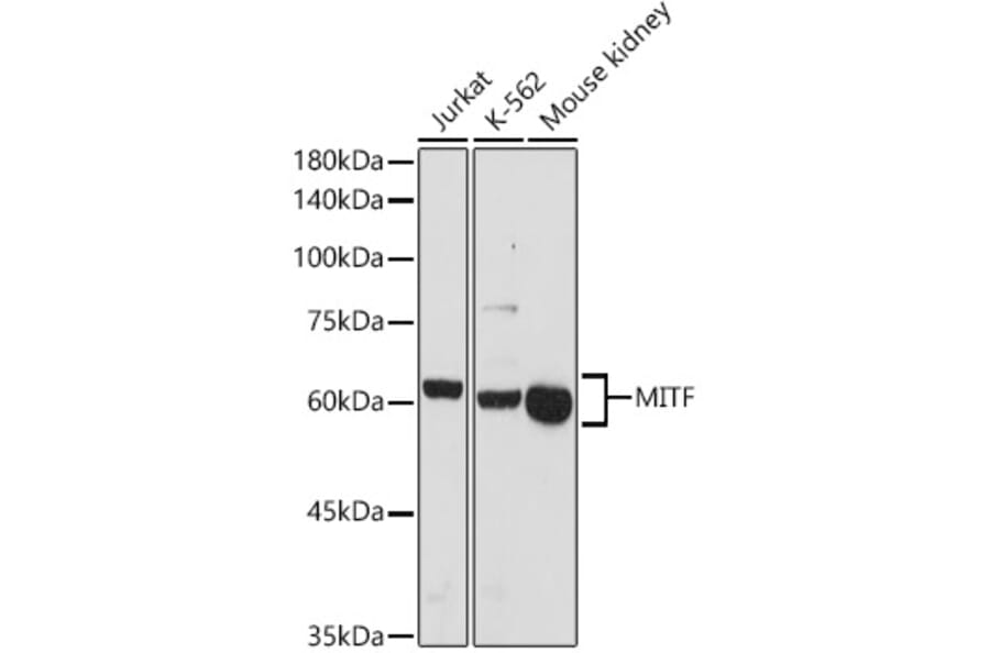 Western Blot - Anti-MiTF Antibody (A13411) - Antibodies.com