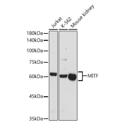 Western Blot - Anti-MiTF Antibody (A13411) - Antibodies.com