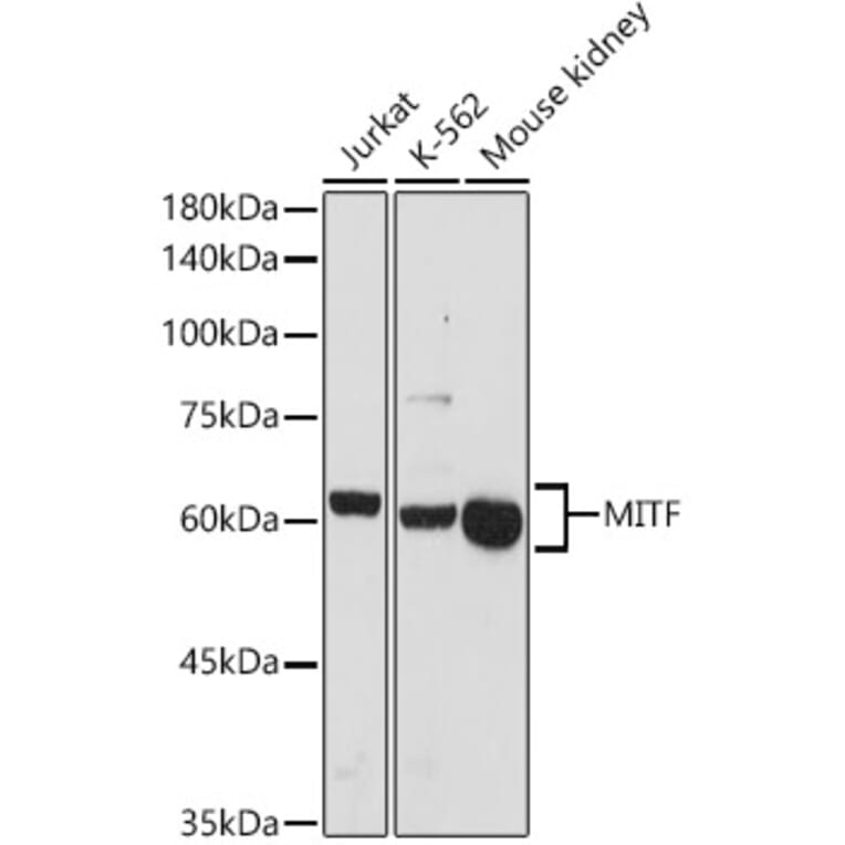 Western Blot - Anti-MiTF Antibody (A13411) - Antibodies.com