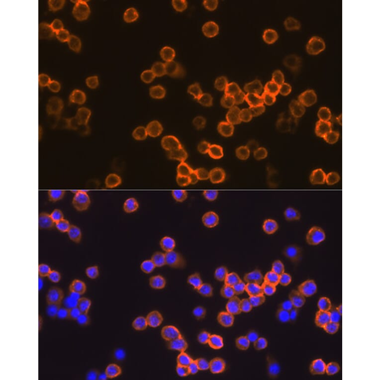 Immunofluorescence - Anti-F4/80 Antibody (A13412) - Antibodies.com