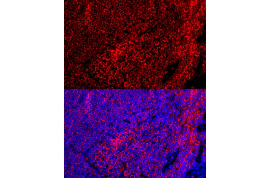 Immunofluorescence - Anti-F4/80 Antibody (A13412) - Antibodies.com