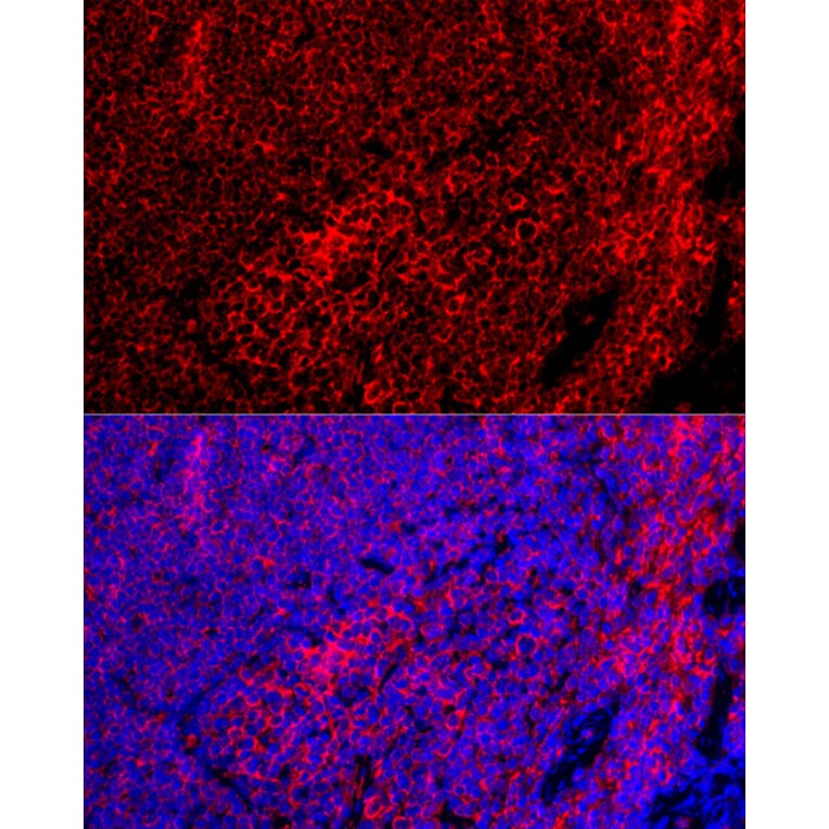 Immunofluorescence - Anti-F4/80 Antibody (A13412) - Antibodies.com