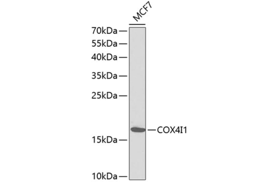 Western Blot - Anti-COX4I1 Antibody (A1263) - Antibodies.com