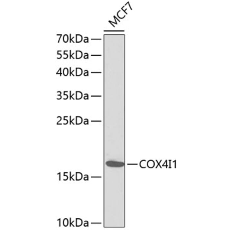 Western Blot - Anti-COX4I1 Antibody (A1263) - Antibodies.com