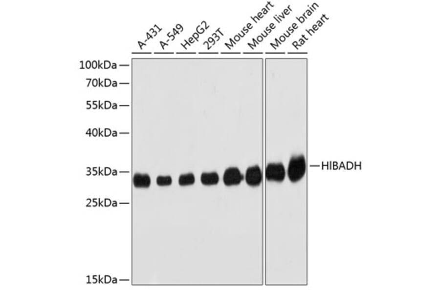 Western Blot - Anti-HIBADH Antibody (A1264) - Antibodies.com