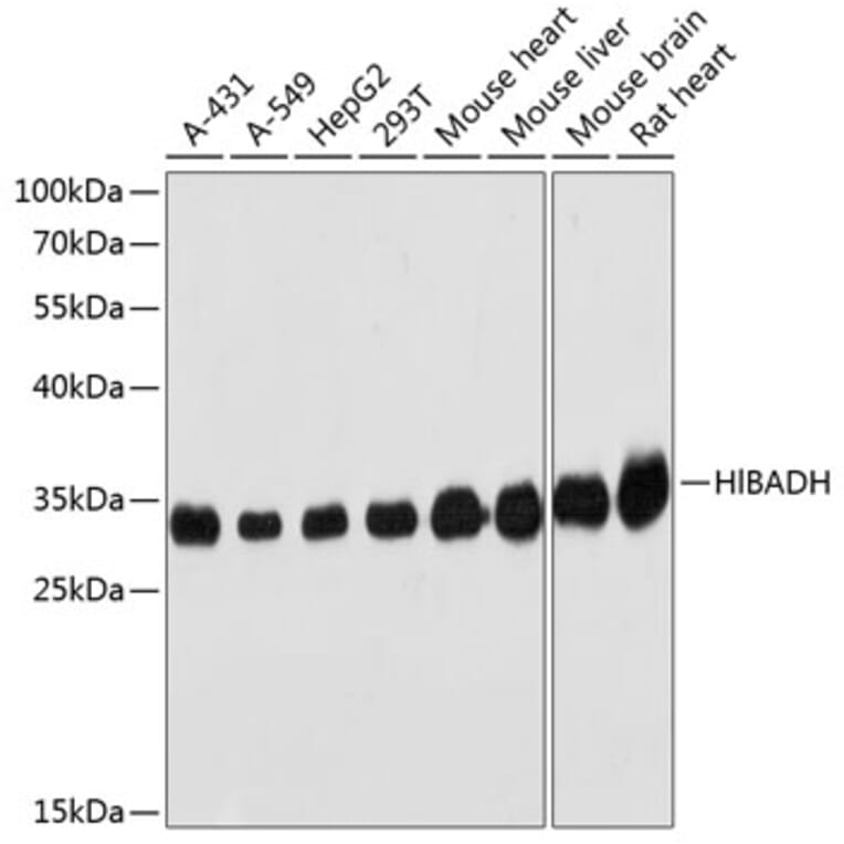 Western Blot - Anti-HIBADH Antibody (A1264) - Antibodies.com