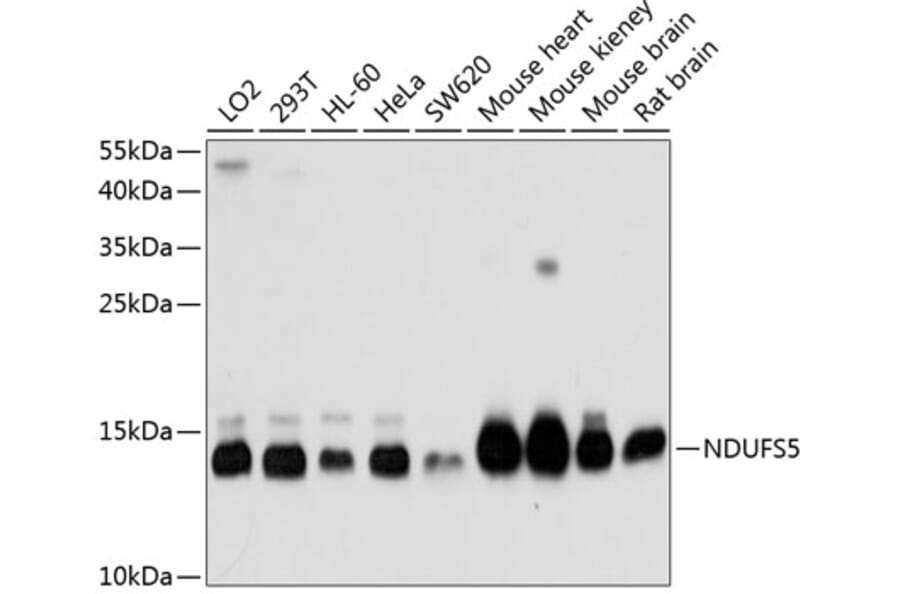 Western Blot - Anti-NDUFS5 Antibody (A1265) - Antibodies.com