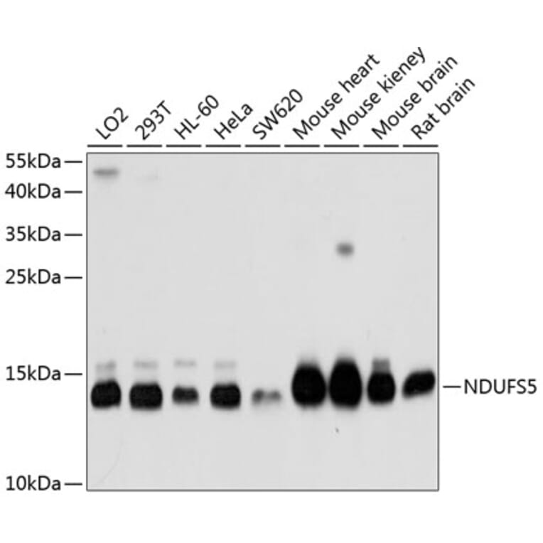 Western Blot - Anti-NDUFS5 Antibody (A1265) - Antibodies.com