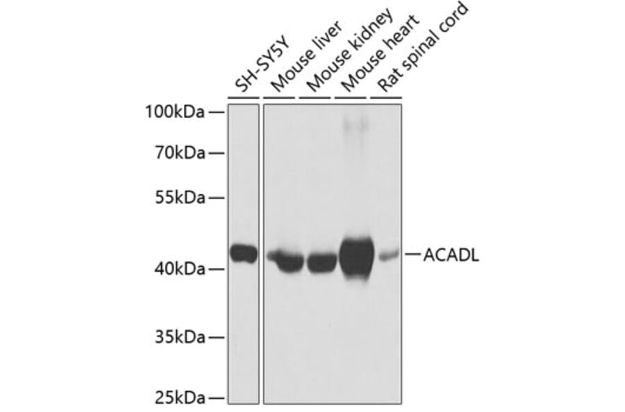 Western Blot - Anti-ACADL/LCAD Antibody (A13416) - Antibodies.com