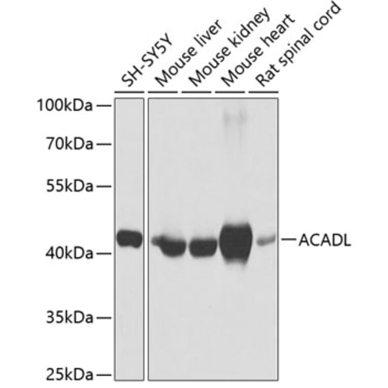 Western Blot - Anti-ACADL/LCAD Antibody (A13416) - Antibodies.com