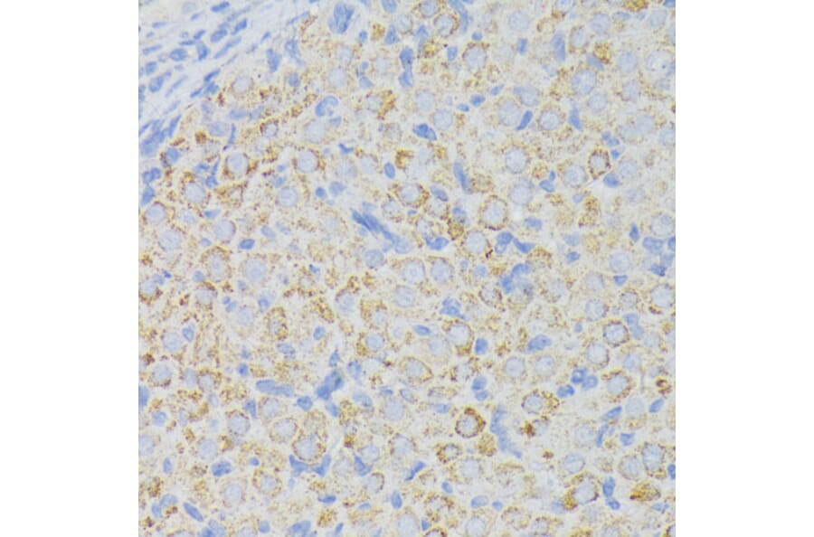 Immunohistochemistry - Anti-ACADL/LCAD Antibody (A13416) - Antibodies.com