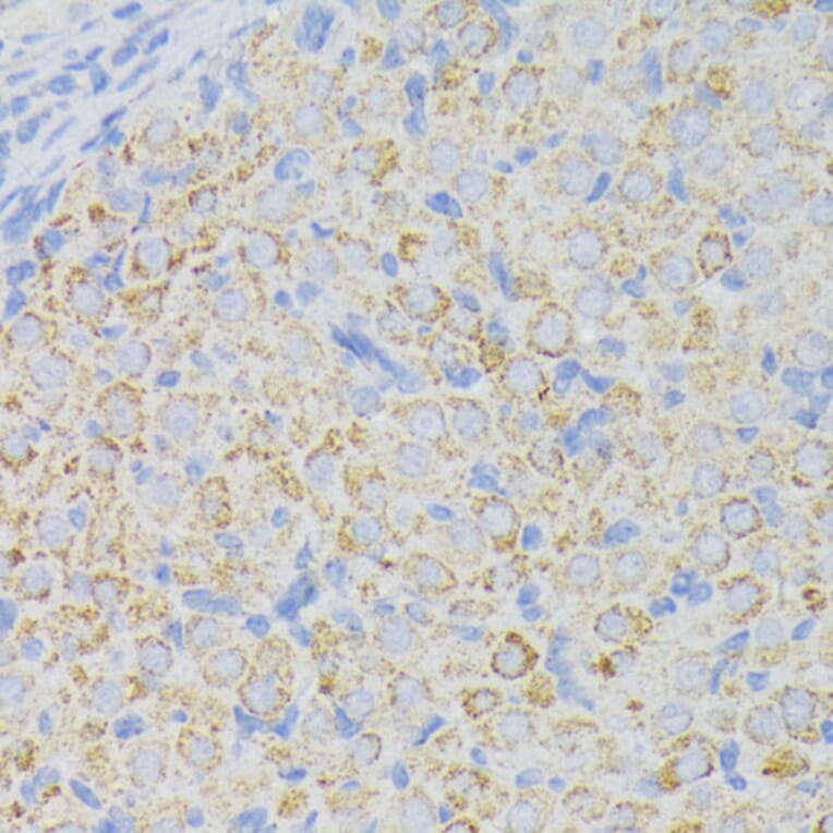 Immunohistochemistry - Anti-ACADL/LCAD Antibody (A13416) - Antibodies.com