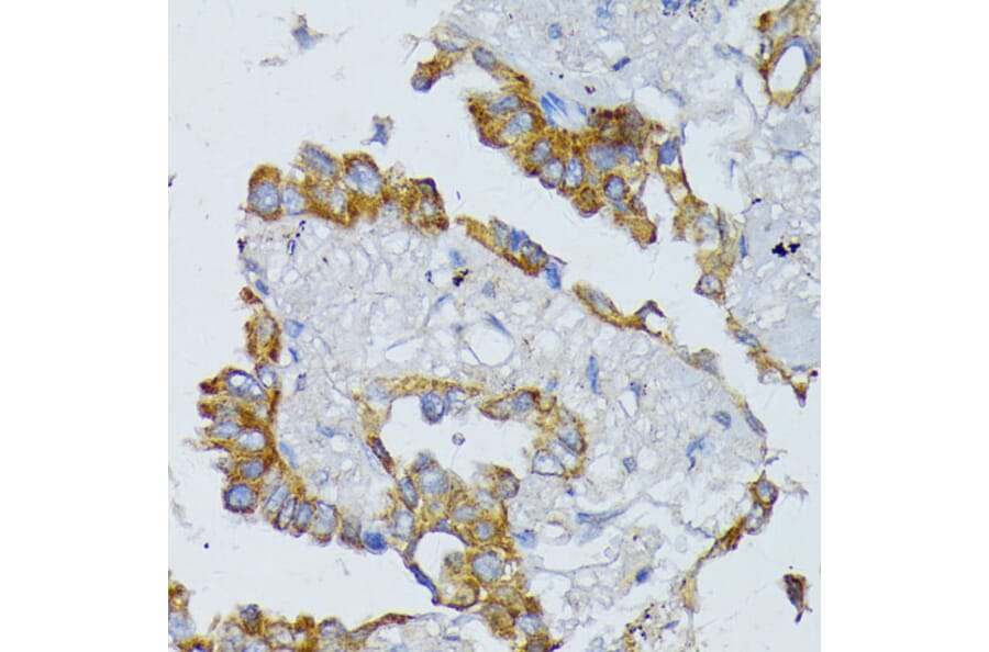 Immunohistochemistry - Anti-ACADL/LCAD Antibody (A13416) - Antibodies.com